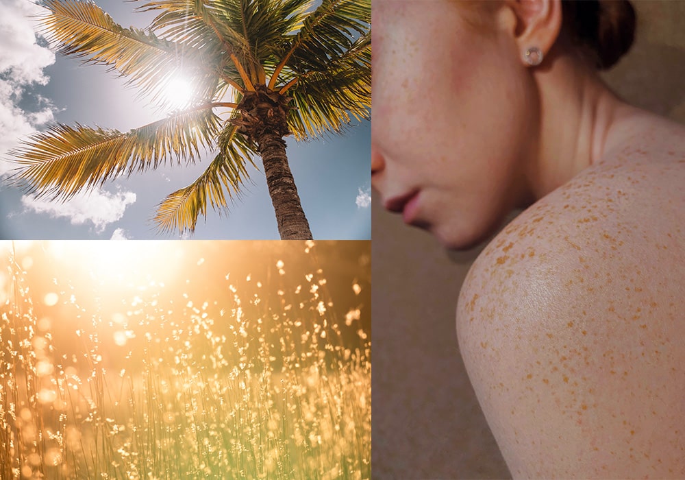 Sonnenallergie – Was tun?