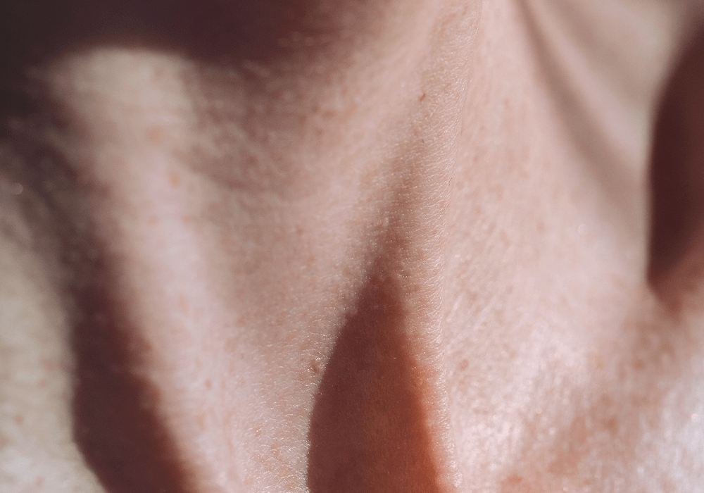 Hautveränderungen: Ursachen, Symptome und Behandlung