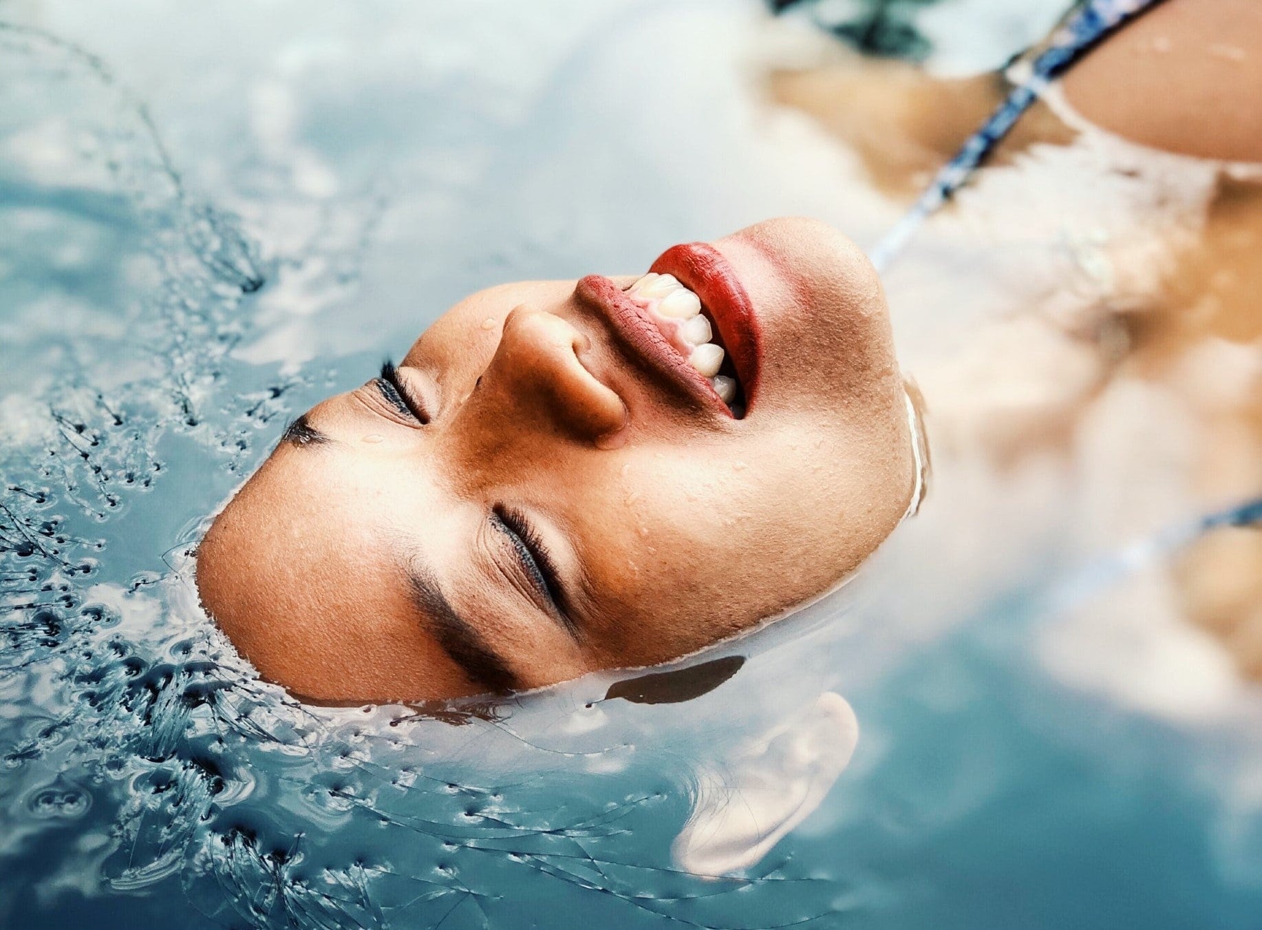 Was hilft bei Perioraler Dermatitis?