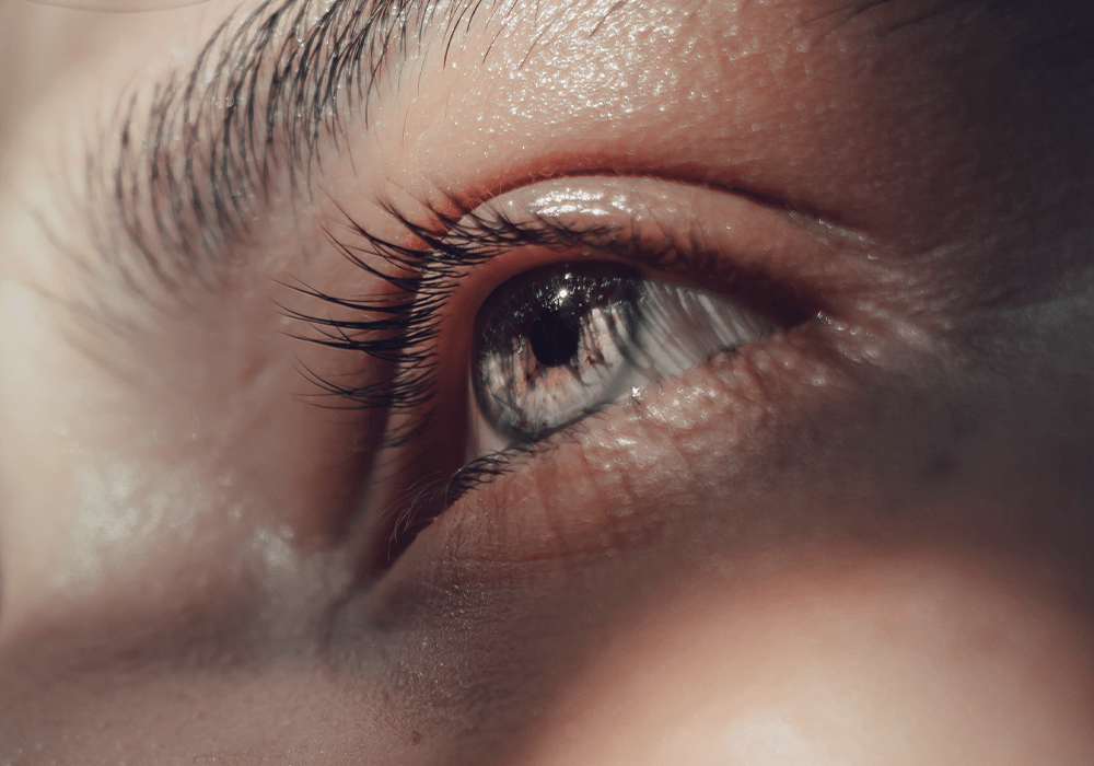 Dunkle Augenringe: Ursachen, Behandlung und hilfreiche Hausmittel