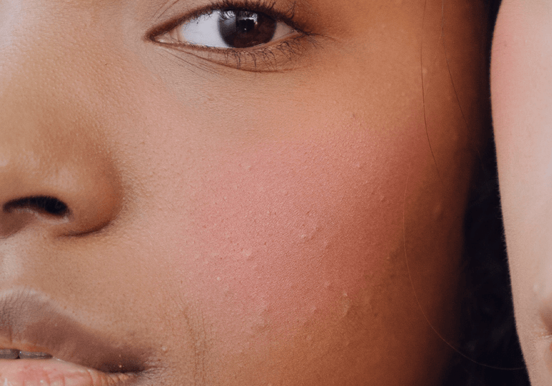 Hautveränderungen – Ursachen, Symptome und Behandlung